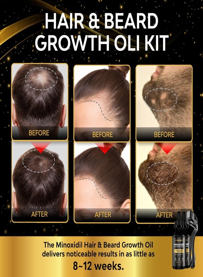 Beaueli Minoxidil Beard Growth Kit For Men and Women, Hair Loss and Hair Regrowth Treatments, Minoxidil 5%, Black 60ml 2 Bottles - Image 2